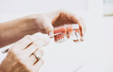 Endodonti (Kanal Tedavisi)
