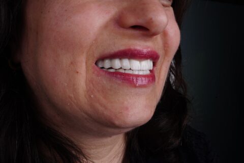 Denta-Istanbul-Happy-Patients (5)