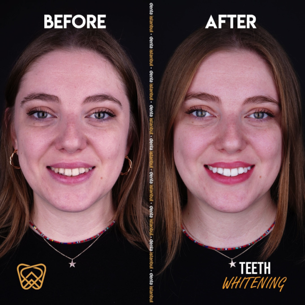 Denta-Istanbul-Happy-Smiles-(12)