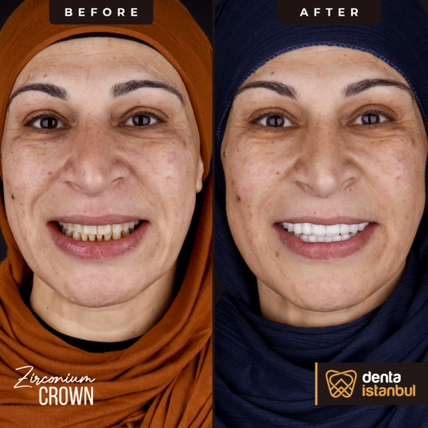Denta-Istanbul-Happy-Smiles (2)