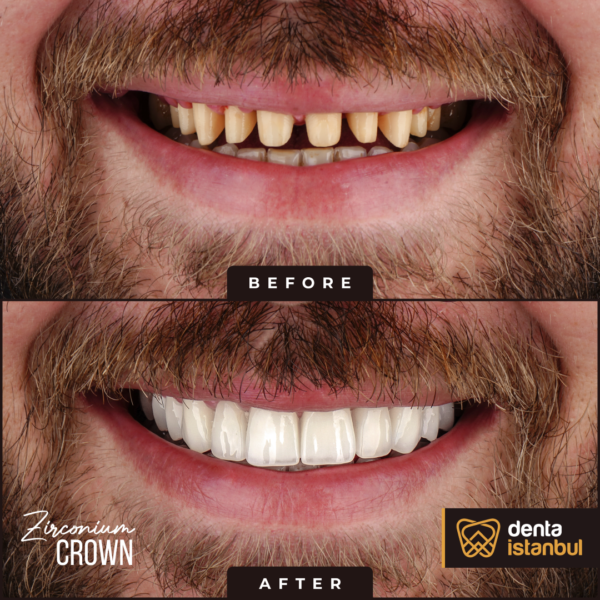 Denta-Istanbul-Happy-Smiles (6)