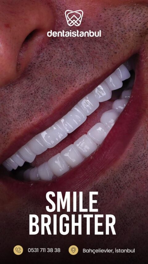 Denta-Istanbul-Patients (8)