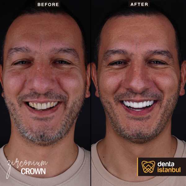 Denta-Istanbul-Happy-Smiles (15)