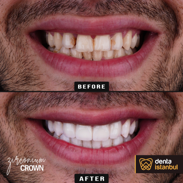 Denta-Istanbul-Happy-Smiles (18)